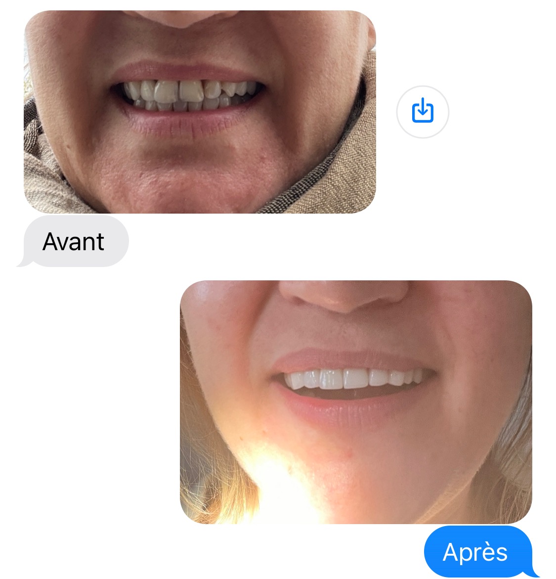 Carousel Dentiste étranger